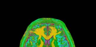 Ressonância magnética mais afinada: inovações tecnológicas agilizam o exame