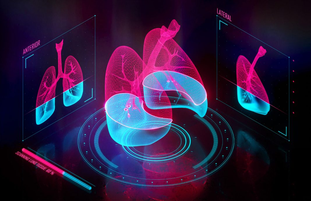 redes-neurais-scaled (1)