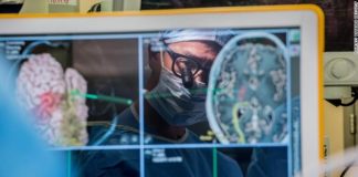 Implante cerebral ajuda homem a ‘falar’ por meio de computador