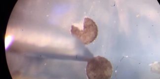 Xenobots: os robôs vivos que se reproduzem por autorreplicação biológica