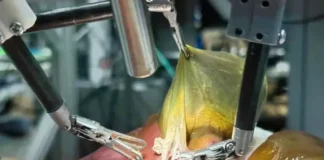 Primeira cirurgia robótica sem humanos é feita com inteligência artificial